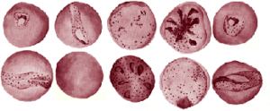 Malaria