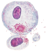 Rickettsia
